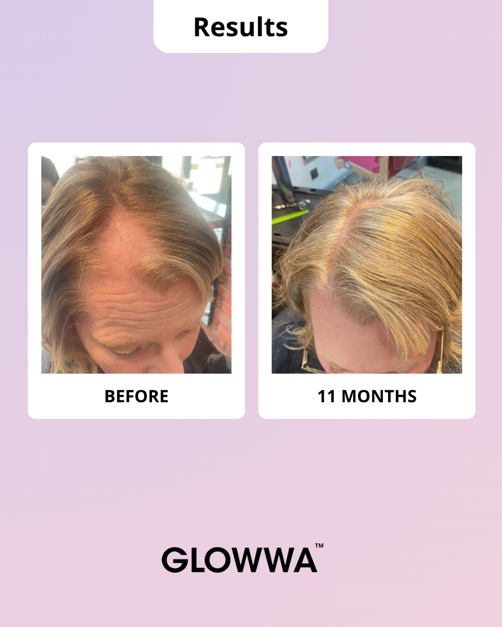 Glowwa Hair Food Meno Eds Hair glowwa-hair-food-meno-eds-hair
