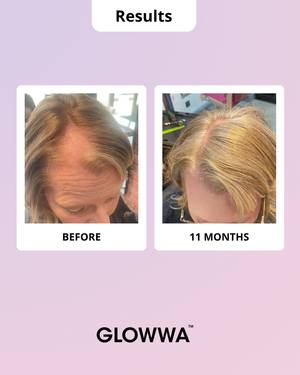 Before and after comparison of hair treatment results with 'GLOWWA' branding on a light purple background.