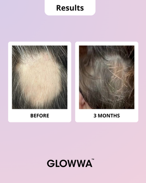Before and after results of a hair treatment product by GLOWWA on a pink background.